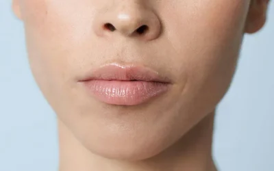 Innovación en Estética: El Perfilado de Labios con Ácido Hialurónico