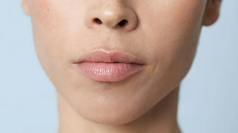 Innovación en Estética: El Perfilado de Labios con Ácido Hialurónico