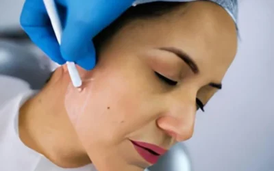 Innovando en Bienestar: El Tratamiento de Bruxismo con Botox